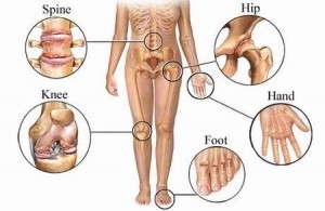 myphysiotherapy orthopedikes pathiseis
